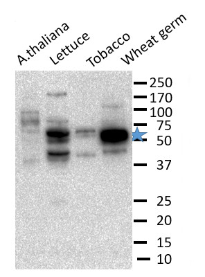 Western blot using anti-eIF5 antibodies